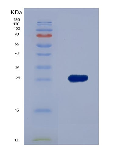 SDS-PAGE analysis of Human PLIN2 (Perilipin-2) - Recombinant Protein, CAT# BLT-02294P, showing >85% purity under 15% SDS-PAGE (Reduced)Human PLIN2 (Perilipin-2) - Recombinant Protein