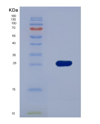 SDS-PAGE analysis of Human PLIN2 (Perilipin-2) - Recombinant Protein, CATHuman PLIN2 (Perilipin-2) - Recombinant Protein