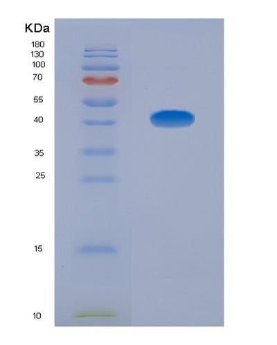 SDS-PAGE analysis of Human CCL13 (C-C Motif Chemokine 13) - Recombinant Protein, CAT# BLT-00435P, showing >85% purity under 15% SDS-PAGE (Reduced)Human CCL13 (C-C Motif Chemokine 13) - Recombinant Protein