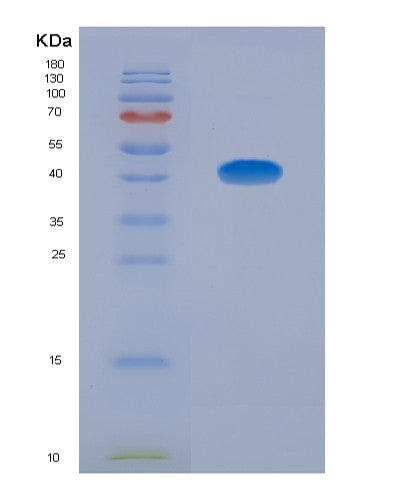 SDS-PAGE analysis of Human CCL13 (C-C Motif Chemokine 13) - Recombinant Protein, CATHuman CCL13 (C-C Motif Chemokine 13) - Recombinant Protein