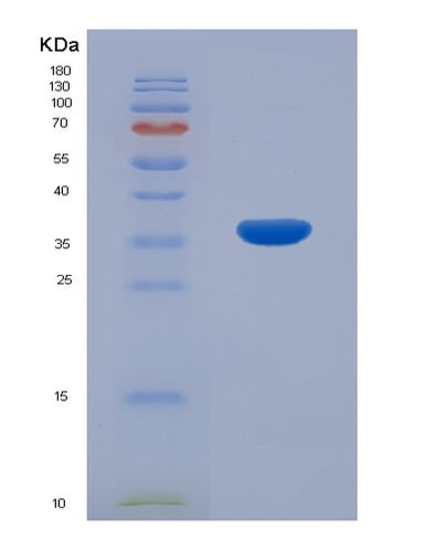 SDS-PAGE analysis of Human MGLL (Monoglyceride Lipase) - Recombinant Protein, CAT# BLT-01845P, showing >95% purity under 15% SDS-PAGE (Reduced)Human MGLL (Monoglyceride Lipase) - Recombinant Protein