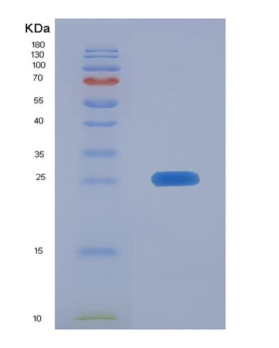 SDS-PAGE analysis of Human CIB1 (Calcium And Integrin-Binding Protein 1) - Recombinant Protein, CAT# BLT-00605P, showing >85% purity under 15% SDS-PAGE (Reduced)Human CIB1 (Calcium And Integrin-Binding Protein 1) - Recombinant Protein