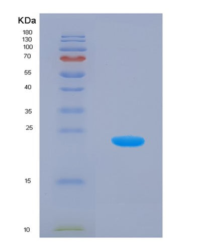 SDS-PAGE analysis of Mouse Park7 (Parkinson Disease Protein 7 Homolog) - Recombinant Protein, CAT# BLT-02157P, showing >95% purity under 15% SDS-PAGE (Reduced)Mouse Park7 (Parkinson Disease Protein 7 Homolog) - Recombinant Protein