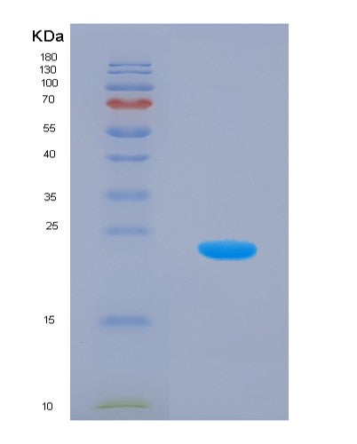 SDS-PAGE analysis of Mouse Park7 (Parkinson Disease Protein 7 Homolog) - Recombinant Protein, CATMouse Park7 (Parkinson Disease Protein 7 Homolog) - Recombinant Protein