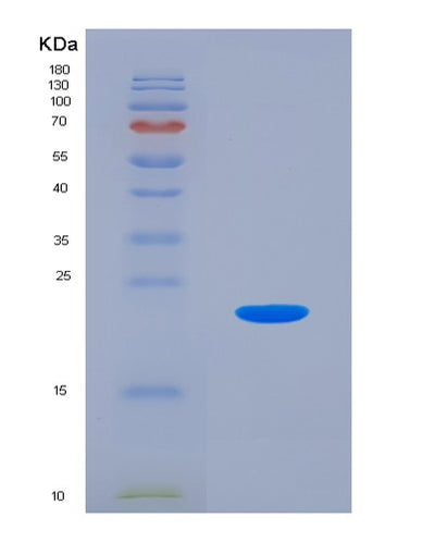 SDS-PAGE analysis of Human HSPB9 (Heat Shock Protein Beta-9) - Recombinant Protein, CAT# BLT-01453P, showing >85% purity under 15% SDS-PAGE (Reduced)Human HSPB9 (Heat Shock Protein Beta-9) - Recombinant Protein