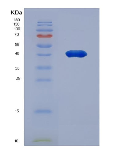 SDS-PAGE analysis of Human FUCA2 (Plasma Alpha-L-Fucosidase) - Recombinant Protein, CAT# BLT-01120P, showing >90% purity under 15% SDS-PAGE (Reduced)Human FUCA2 (Plasma Alpha-L-Fucosidase) - Recombinant Protein