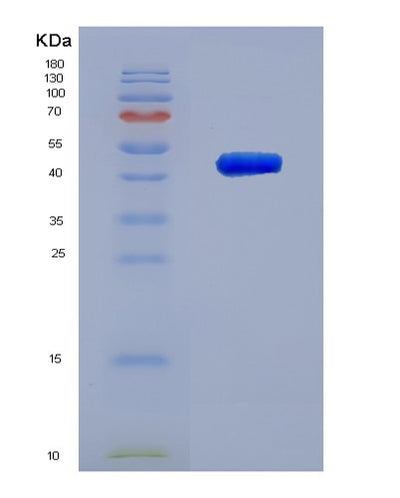 SDS-PAGE analysis of Human VAMP8 (Vesicle-Associated Membrane Protein 8) - Recombinant Protein, CAT# BLT-03268P, showing >90% purity under 15% SDS-PAGE (Reduced)Human VAMP8 (Vesicle-Associated Membrane Protein 8) - Recombinant Protein