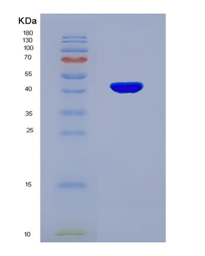SDS-PAGE analysis of Human ACAT2 (Acetyl-Coa Acetyltransferase, Cytosolic) - Recombinant Protein, CAT# BLT-00031P, showing >95% purity under 15% SDS-PAGE (Reduced)Human ACAT2 (Acetyl-Coa Acetyltransferase, Cytosolic) - Recombinant Protein