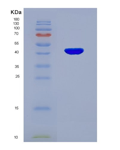 SDS-PAGE analysis of Human ACAT2 (Acetyl-Coa Acetyltransferase, Cytosolic) - Recombinant Protein, CATHuman ACAT2 (Acetyl-Coa Acetyltransferase, Cytosolic) - Recombinant Protein