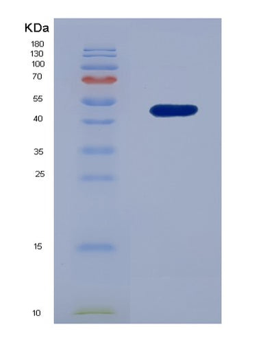 SDS-PAGE analysis of Human MCM5 (Dna Replication Licensing Factor Mcm5) - Recombinant Protein, CAT# BLT-07766P, showing >90% purity under 15% SDS-PAGE (Reduced)Human MCM5 (Dna Replication Licensing Factor Mcm5) - Recombinant Protein