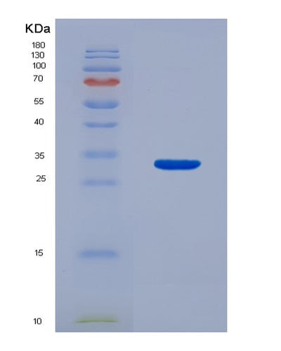 SDS-PAGE analysis of Human CDC6 (Cell Division Control Protein 6 Homolog) - Recombinant Protein, CAT# BLT-07767P, showing >90% purity under 15% SDS-PAGE (Reduced)Human CDC6 (Cell Division Control Protein 6 Homolog) - Recombinant Protein