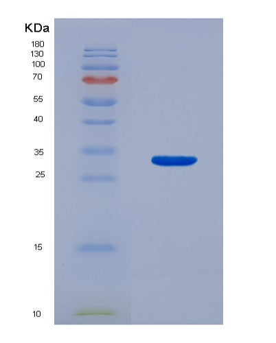 SDS-PAGE analysis of Human CDC6 (Cell Division Control Protein 6 Homolog) - Recombinant Protein, CATHuman CDC6 (Cell Division Control Protein 6 Homolog) - Recombinant Protein
