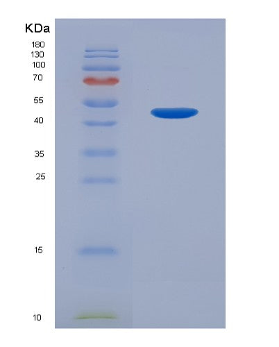 SDS-PAGE analysis of Human LGMN (Legumain) - Recombinant Protein, CATHuman LGMN (Legumain) - Recombinant Protein