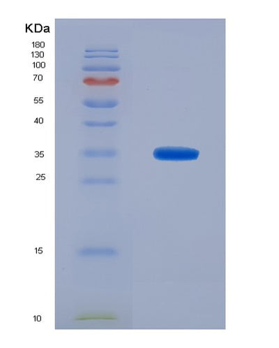 SDS-PAGE analysis of Mouse Dhrs9 (Dehydrogenase/Reductase Sdr Family Member 9) - Recombinant Protein, CAT# BLT-07772P, showing >90% purity under 15% SDS-PAGE (Reduced)Mouse Dhrs9 (Dehydrogenase/Reductase Sdr Family Member 9) - Recombinant Protein
