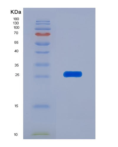 SDS-PAGE analysis of Human ITPA (Inosine Triphosphate Pyrophosphatase) - Recombinant Protein, CAT# BLT-01597P, showing >85% purity under 15% SDS-PAGE (Reduced)Human ITPA (Inosine Triphosphate Pyrophosphatase) - Recombinant Protein