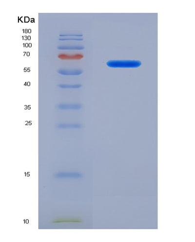 SDS-PAGE analysis of Human CADM1 (Cell Adhesion Molecule 1) - Recombinant Protein, CAT# BLT-00388P, showing >90% purity under 15% SDS-PAGE (Reduced)Human CADM1 (Cell Adhesion Molecule 1) - Recombinant Protein