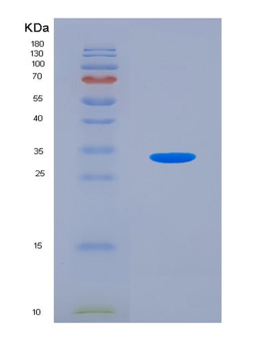 SDS-PAGE analysis of Mouse Atp1b1 (Sodium/Potassium-Transporting Atpase Subunit Beta-1) - Recombinant Protein, CAT# BLT-07775P, showing >90% purity under 15% SDS-PAGE (Reduced)Mouse Atp1b1 (Sodium/Potassium-Transporting Atpase Subunit Beta-1) - Recombinant Protein