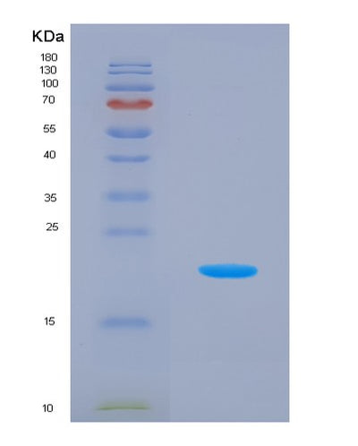 SDS-PAGE analysis of Human MRPL1 (Large Ribosomal Subunit Protein Ul1M) - Recombinant Protein, CAT# BLT-01900P, showing >95% purity under 15% SDS-PAGE (Reduced)Human MRPL1 (Large Ribosomal Subunit Protein Ul1M) - Recombinant Protein
