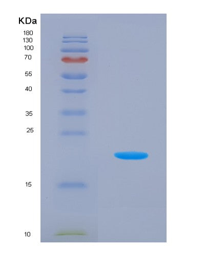 SDS-PAGE analysis of Human MRPL1 (Large Ribosomal Subunit Protein Ul1M) - Recombinant Protein, CATHuman MRPL1 (Large Ribosomal Subunit Protein Ul1M) - Recombinant Protein