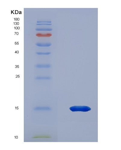 SDS-PAGE analysis of Human PKIB (Camp-Dependent Protein Kinase Inhibitor Beta) - Recombinant Protein, CATHuman PKIB (Camp-Dependent Protein Kinase Inhibitor Beta) - Recombinant Protein