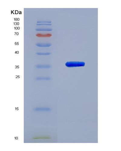 SDS-PAGE analysis of Human TRIM5 (Tripartite Motif-Containing Protein 5) - Recombinant Protein, CAT# BLT-04578P, showing >95% purity under 15% SDS-PAGE (Reduced)Human TRIM5 (Tripartite Motif-Containing Protein 5) - Recombinant Protein