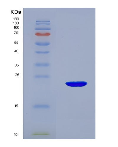 SDS-PAGE analysis of Mouse Glo1 (Lactoylglutathione Lyase) - Recombinant Protein, CAT# BLT-05419P, showing >95% purity under 15% SDS-PAGE (Reduced)Mouse Glo1 (Lactoylglutathione Lyase) - Recombinant Protein