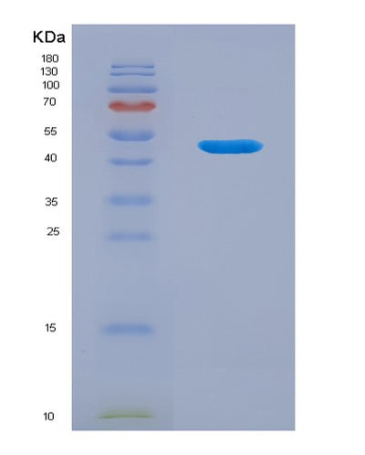 SDS-PAGE analysis of Human LACRT (Extracellular Glycoprotein Lacritin) - Recombinant Protein, CAT# BLT-04220P, showing >95% purity under 15% SDS-PAGE (Reduced)Human LACRT (Extracellular Glycoprotein Lacritin) - Recombinant Protein