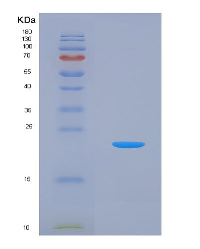 SDS-PAGE analysis of Human UBA5 (Ubiquitin-Like Modifier-Activating Enzyme 5) - Recombinant Protein, CAT# BLT-03188P, showing >95% purity under 15% SDS-PAGE (Reduced)Human UBA5 (Ubiquitin-Like Modifier-Activating Enzyme 5) - Recombinant Protein