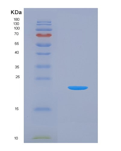 SDS-PAGE analysis of Human UBA5 (Ubiquitin-Like Modifier-Activating Enzyme 5) - Recombinant Protein, CATHuman UBA5 (Ubiquitin-Like Modifier-Activating Enzyme 5) - Recombinant Protein
