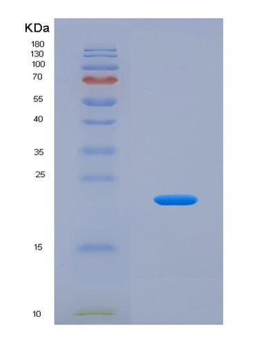 SDS-PAGE analysis of Human ZBP1 (Z-Dna-Binding Protein 1) - Recombinant Protein, CAT# BLT-04759P, showing >90% purity under 15% SDS-PAGE (Reduced)Human ZBP1 (Z-Dna-Binding Protein 1) - Recombinant Protein