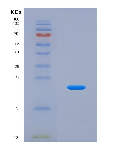 SDS-PAGE analysis of Human ZBP1 (Z-Dna-Binding Protein 1) - Recombinant Protein, CATHuman ZBP1 (Z-Dna-Binding Protein 1) - Recombinant Protein