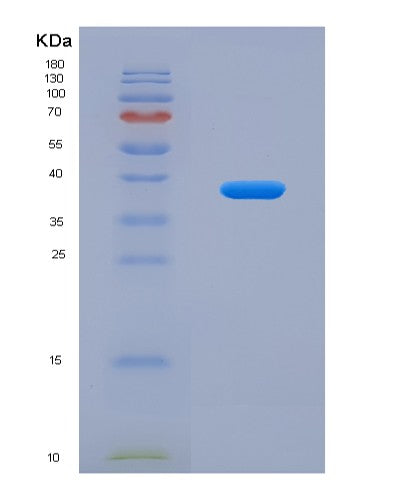 SDS-PAGE analysis of Human SDCBP2 (Syntenin-2) - Recombinant Protein, CATHuman SDCBP2 (Syntenin-2) - Recombinant Protein