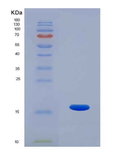 SDS-PAGE analysis of Human RNASE7 (Ribonuclease 7) - Recombinant Protein, CAT# BLT-02593P, showing >95% purity under 15% SDS-PAGE (Reduced)Human RNASE7 (Ribonuclease 7) - Recombinant Protein