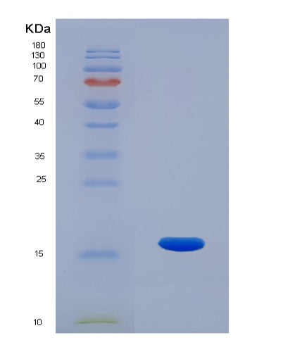 SDS-PAGE analysis of Human RNASE7 (Ribonuclease 7) - Recombinant Protein, CATHuman RNASE7 (Ribonuclease 7) - Recombinant Protein