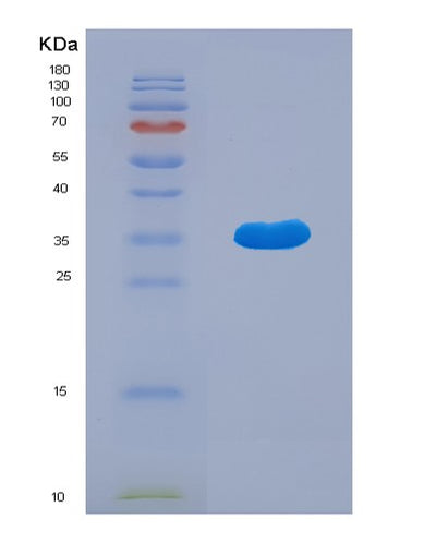 SDS-PAGE analysis of Human ATG5 (Autophagy Protein 5) - Recombinant Protein, CAT# BLT-00255P, showing >95% purity under 15% SDS-PAGE (Reduced)Human ATG5 (Autophagy Protein 5) - Recombinant Protein
