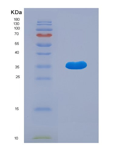 SDS-PAGE analysis of Human ATG5 (Autophagy Protein 5) - Recombinant Protein, CATHuman ATG5 (Autophagy Protein 5) - Recombinant Protein