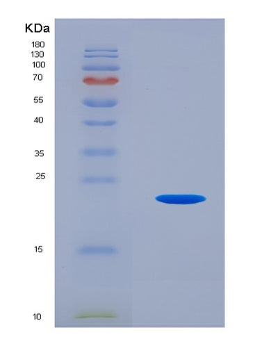 SDS-PAGE analysis of Human IL25 (Interleukin-25) - Recombinant Protein, CAT# BLT-02754P, showing >85% purity under 15% SDS-PAGE (Reduced)Human IL25 (Interleukin-25) - Recombinant Protein