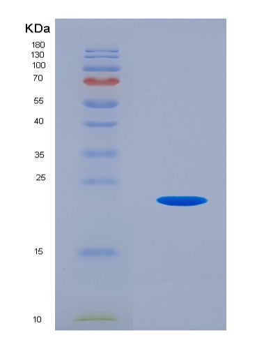 SDS-PAGE analysis of Human IL25 (Interleukin-25) - Recombinant Protein, CATHuman IL25 (Interleukin-25) - Recombinant Protein