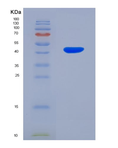 SDS-PAGE analysis of Human BHMT2 (S-Methylmethionine--Homocysteine S-Methyltransferase Bhmt2) - Recombinant Protein, CAT# BLT-00321P, showing >85% purity under 15% SDS-PAGE (Reduced)Human BHMT2 (S-Methylmethionine--Homocysteine S-Methyltransferase Bhmt2) - Recombinant Protein