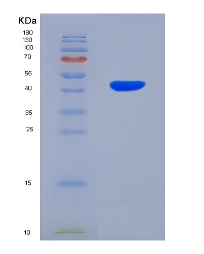 SDS-PAGE analysis of Human BHMT2 (S-Methylmethionine--Homocysteine S-Methyltransferase Bhmt2) - Recombinant Protein, CATHuman BHMT2 (S-Methylmethionine--Homocysteine S-Methyltransferase Bhmt2) - Recombinant Protein
