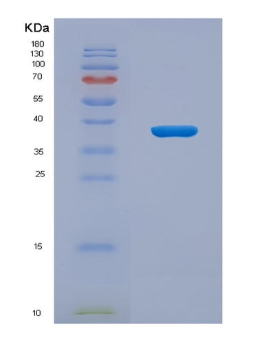 SDS-PAGE analysis of Human CENPH (Centromere Protein H) - Recombinant Protein, CAT# BLT-00561P, showing >95% purity under 15% SDS-PAGE (Reduced)Human CENPH (Centromere Protein H) - Recombinant Protein