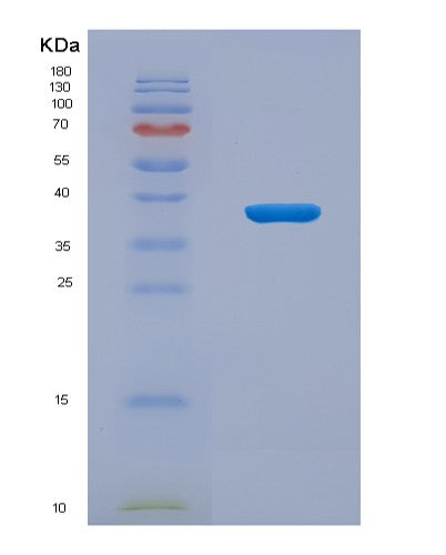 SDS-PAGE analysis of Human CENPH (Centromere Protein H) - Recombinant Protein, CATHuman CENPH (Centromere Protein H) - Recombinant Protein