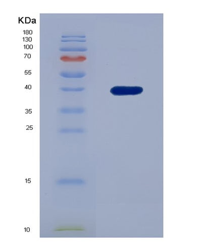 SDS-PAGE analysis of Human FN3K (Fructosamine-3-Kinase) - Recombinant Protein, CAT# BLT-01100P, showing >85% purity under 15% SDS-PAGE (Reduced)Human FN3K (Fructosamine-3-Kinase) - Recombinant Protein