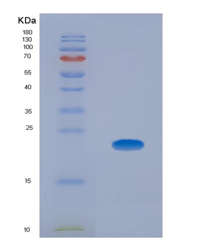SDS-PAGE analysis of Human CLMP (Cxadr-Like Membrane Protein) - Recombinant Protein, CAT# BLT-00629P, showing >95% purity under 15% SDS-PAGE (Reduced)Human CLMP (Cxadr-Like Membrane Protein) - Recombinant Protein