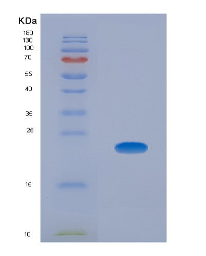 SDS-PAGE analysis of Human CLMP (Cxadr-Like Membrane Protein) - Recombinant Protein, CATHuman CLMP (Cxadr-Like Membrane Protein) - Recombinant Protein