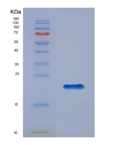 SDS-PAGE analysis of Human GREM2 (Gremlin-2) - Recombinant Protein, CAT# BLT-01276P, showing >95% purity under 15% SDS-PAGE (Reduced)Human GREM2 (Gremlin-2) - Recombinant Protein