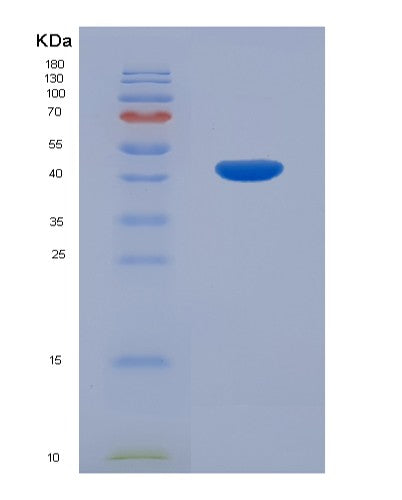 SDS-PAGE analysis of Human NHEJ1 (Non-Homologous End-Joining Factor 1) - Recombinant Protein, CATHuman NHEJ1 (Non-Homologous End-Joining Factor 1) - Recombinant Protein
