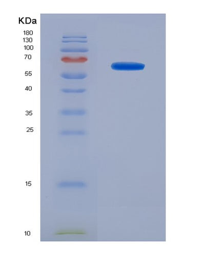 SDS-PAGE analysis of Human NANOG (Homeobox Protein Nanog) - Recombinant Protein, CAT# BLT-01960P, showing >95% purity under 15% SDS-PAGE (Reduced)Human NANOG (Homeobox Protein Nanog) - Recombinant Protein
