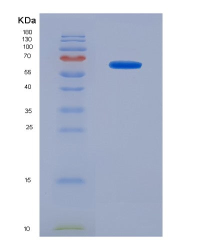 SDS-PAGE analysis of Human NANOG (Homeobox Protein Nanog) - Recombinant Protein, CATHuman NANOG (Homeobox Protein Nanog) - Recombinant Protein