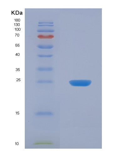 SDS-PAGE analysis of Human UCK1 (Uridine-Cytidine Kinase 1) - Recombinant Protein, CATHuman UCK1 (Uridine-Cytidine Kinase 1) - Recombinant Protein